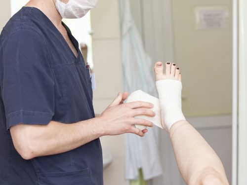 Diagnóstico de la fractura de tobillo expuesta
