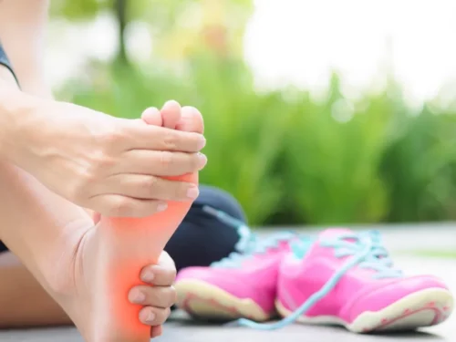 Fascitis plantar externa: Nuestro enfoque para su diagnóstico y tratamiento