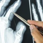 Radiografías ortopédicas: ¿qué pueden detectar y cuándo solicitarlas?